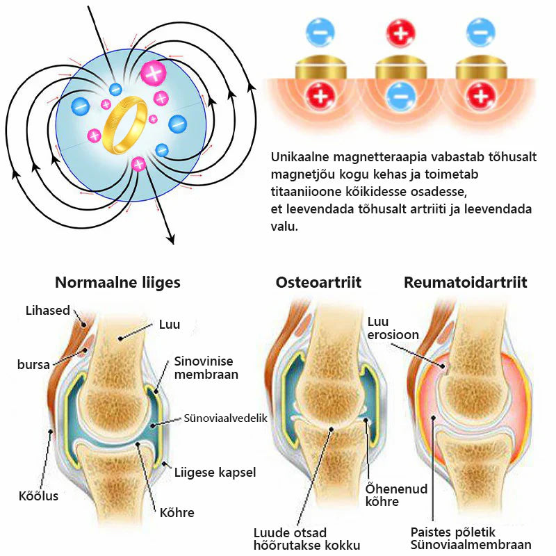 CZTICLE™ lümfimagnetteraapia rõngas kassidele💖 Piiratud aja pakkumine👑👑