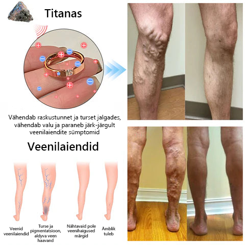 CZTICLE titaanterasest magnetravi sõrmus loodusliku teemandiga 🔥 Osta rohkem, säästa rohkem 🔥🔥