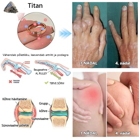 CZTICLE titaanterasest magnetravi sõrmus loodusliku teemandiga 🔥 Osta rohkem, säästa rohkem 🔥🔥